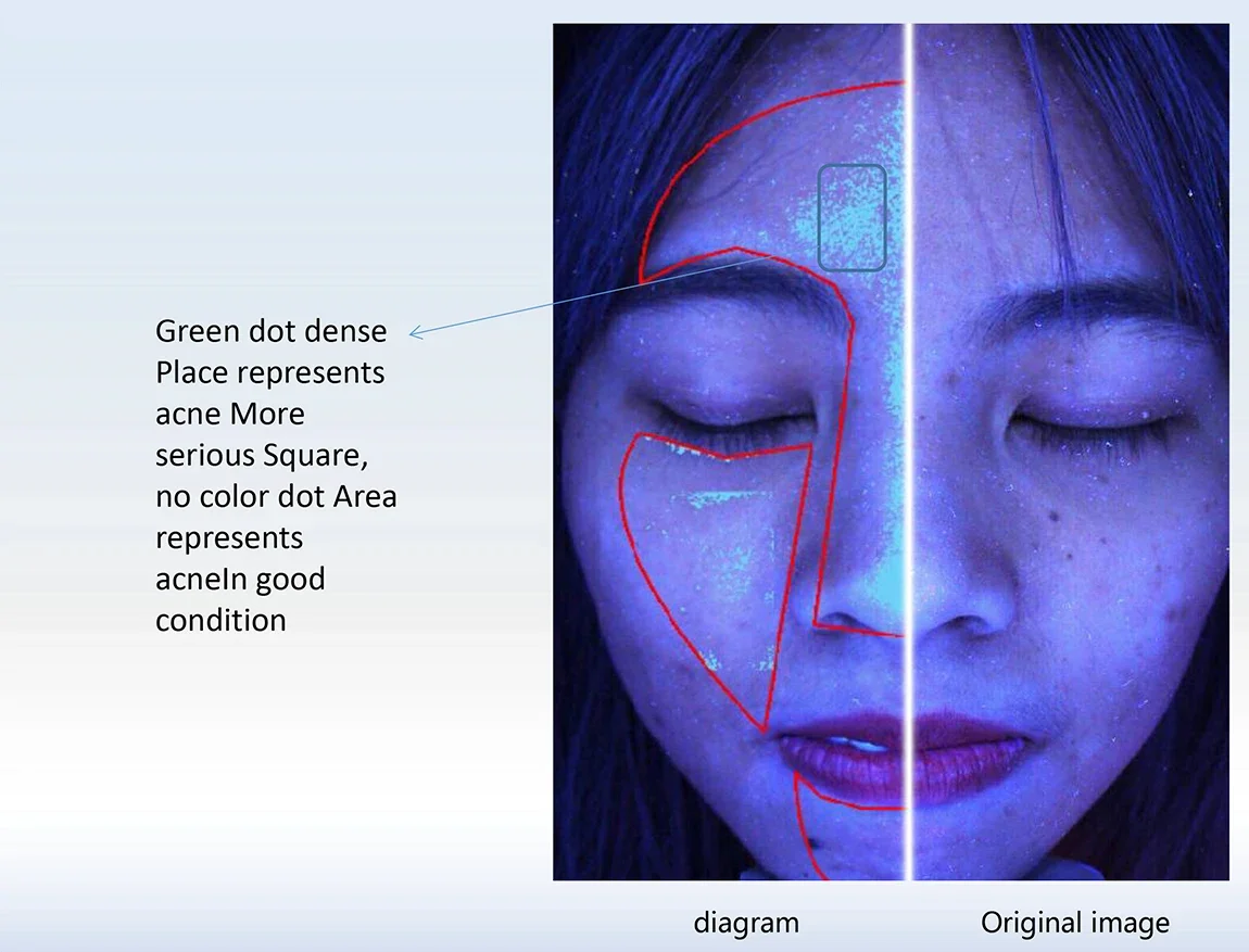 Portable 3d facial detector skin analyzer face scanner skin analyser skin analysis machine