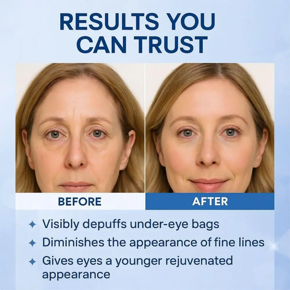 Firming Eye Lift Formula Under Eye Tightening Serum Reduce Bags Fine Lines Polysaccharide Eye Serum Puffiness Dark Circles