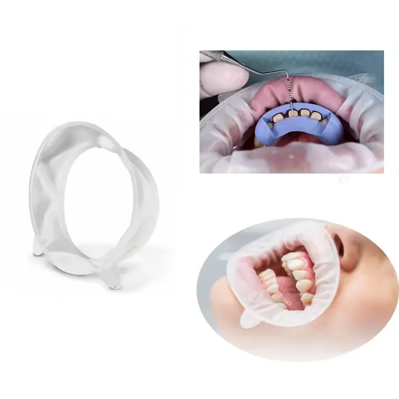 10PCS Dental Mouth Opener 3D Oral Lip Cheek Retractor O Shape Rubber Expander for Regular Small Junior Dentistry Tool Set