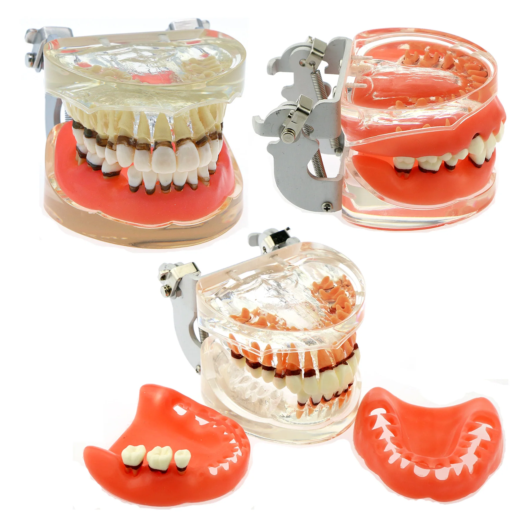 

Dental Teeth Model Dental Periodontal Disease Gingivas Recession Dentists Teaching Model Demonstration