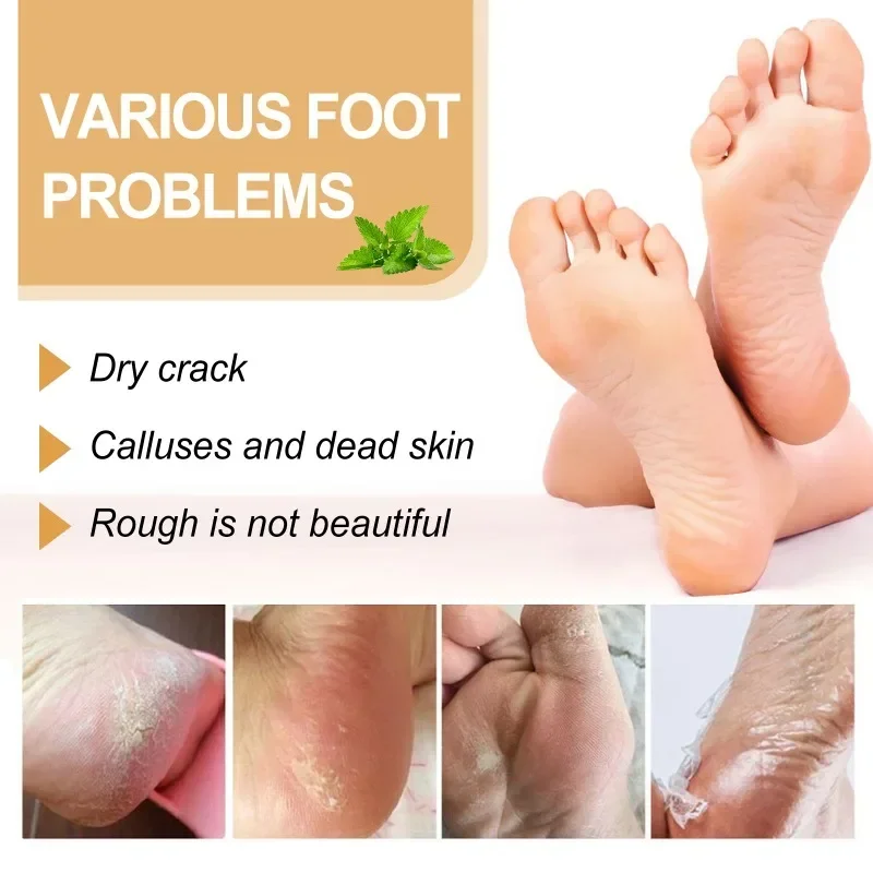 Sdatter Foot Callus Remover Spray Quickly Soften Calluses Exfoliation Dry Feet Skin Hydrating clean Dead repair Skin cuticles Fo