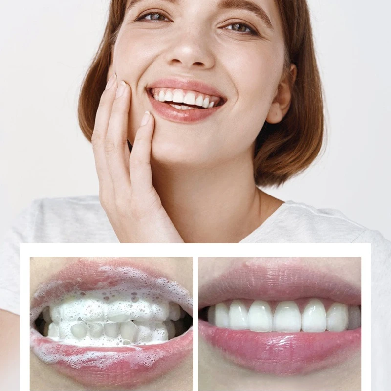 Tablets White Peach Flavors Probiotic Toothpaste Tablets Improve Bad Breath Fresh Oral Remove Bad Stains Solid Toothpaste Tablet