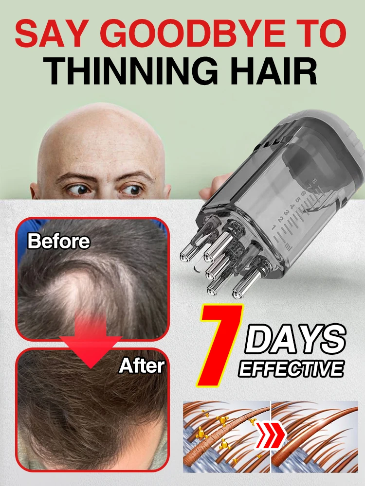 

Tell Alpha about Hair Thinning, Hair Care, Repair and Prevention of Hair Thinning