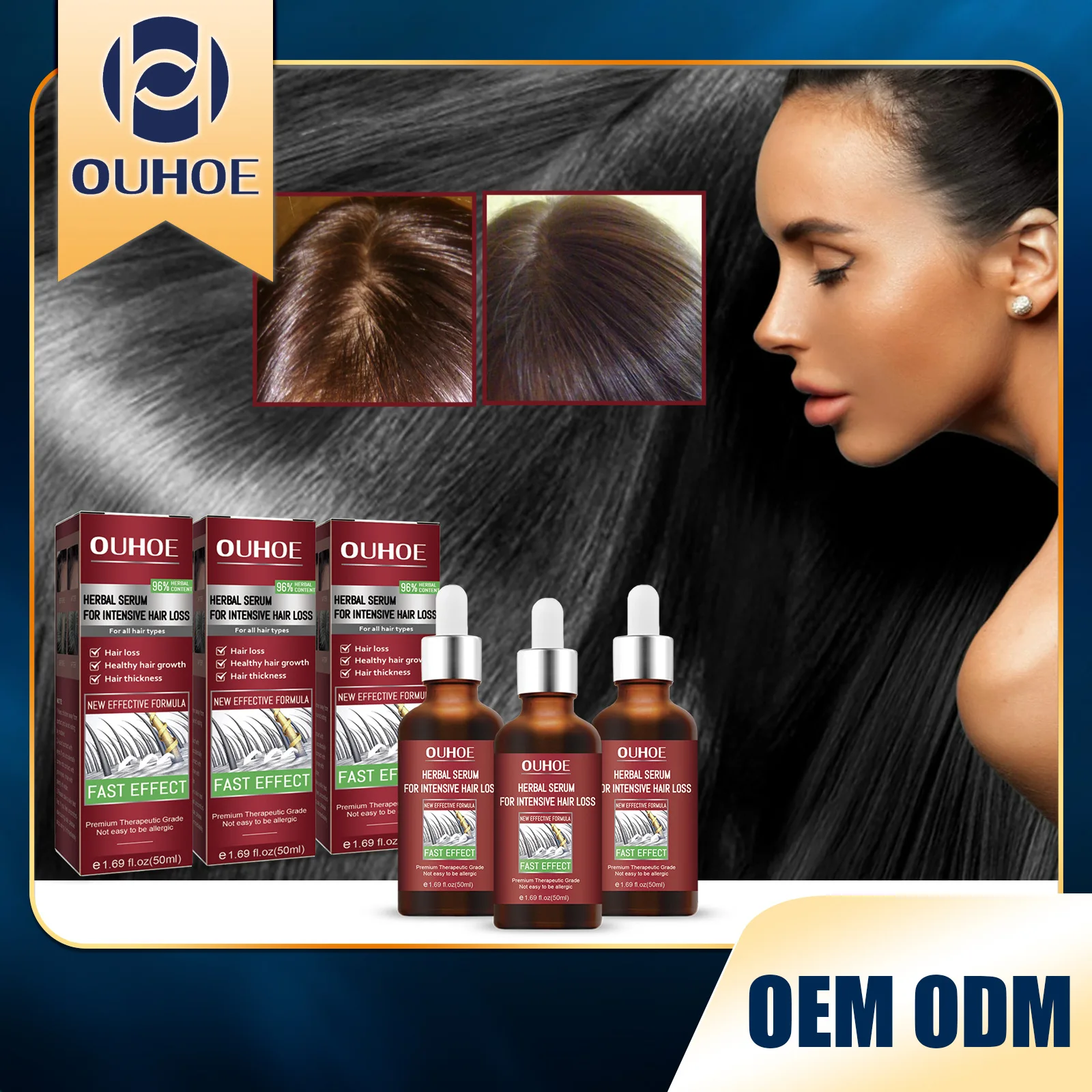 

Hair Growth essence Moisturizes Hair Root, Rapidly Grows Hair, Prevents Hair Loss, Strengthens, Firms and Protects Hair essence