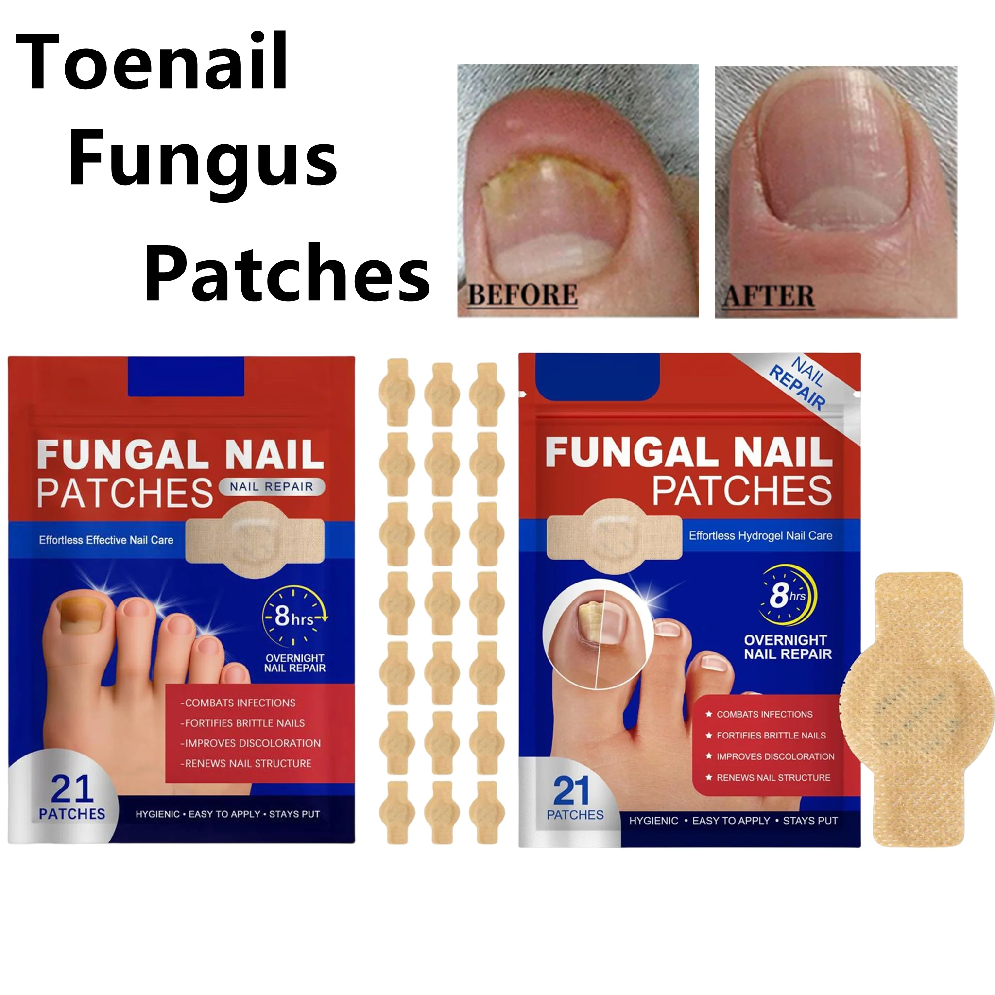 21Pcs Toenail Fungus Patches Waterproof Nail Repair Patches Nail Ingrown Correction Stickers For Discolored Or Damaged Nails