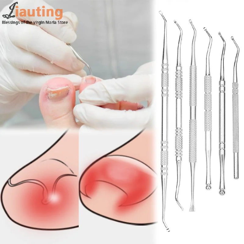 Ensemble d'outils de Correction des ongles incarnés, 6 pièces, limes à ongles à Double extrémité en acier inoxydable, soins Paronychia, outils de nettoyage des pieds