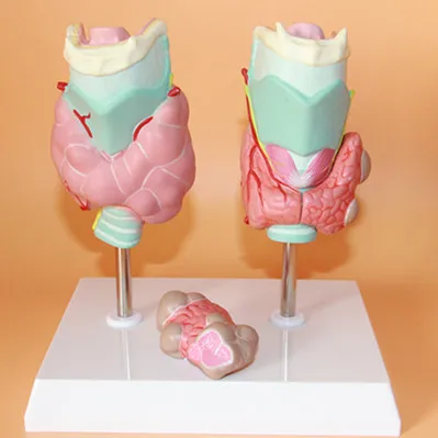 Thyroid pathology model Thyroid tumor Throat Thyroid anatomy model