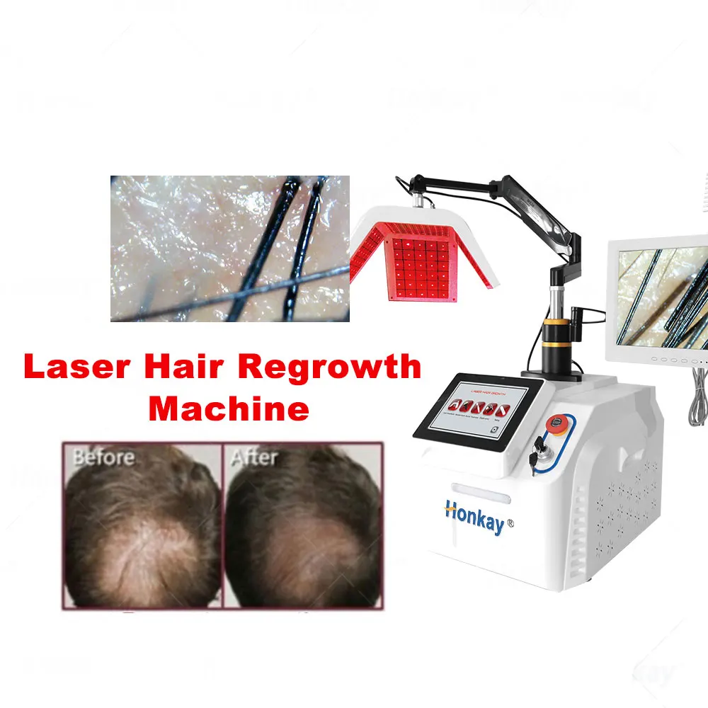 Professional Laser Hair Growth Machine Hair Regrowth Treatment Scalp Analyzer 650nm Diode Laser Hair Restoration Salon Device