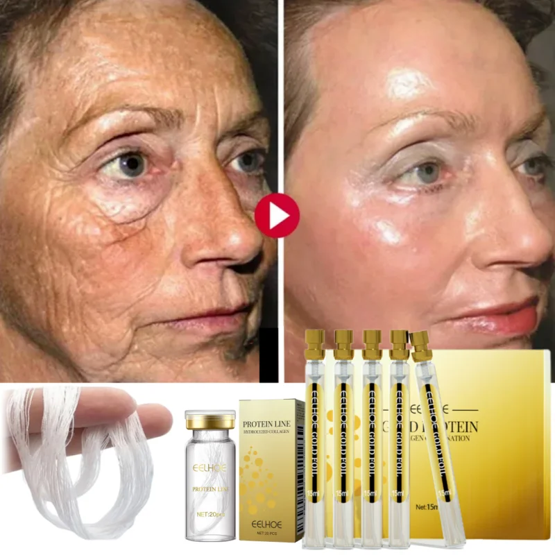 Lifting instantané du visage avec fil de collagène, déformable, élimine les fils solubles, ensemble de sérum 10000, remplisseur de visage absorbant, anti-âge, soins de la peau