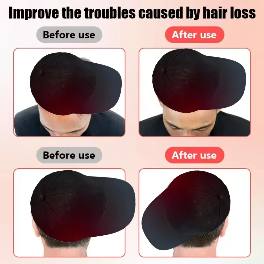 

Low Level Laser Therapy Cap 650nm, LLLT Hair Growth Device for Treating Thinning Hair and Baldness, Stimulates Hair Regrowth