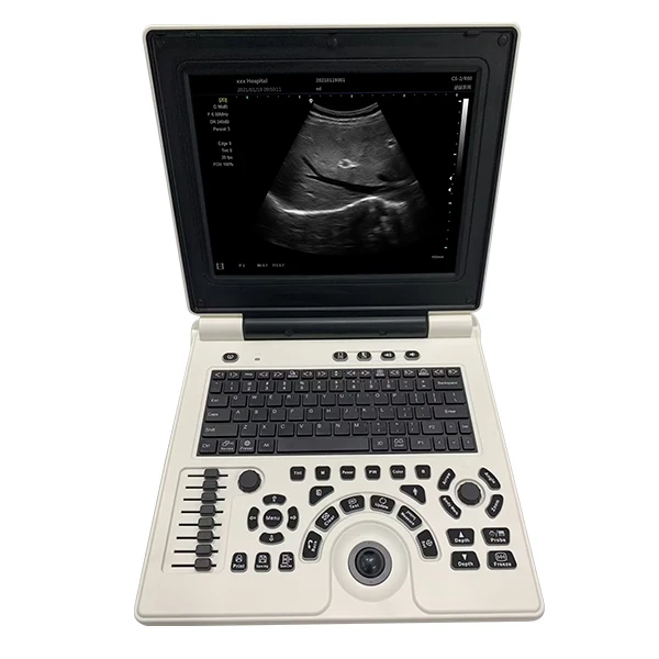 C2 CHEAP COLOR DOPPLER Portable Ultrasound Machine 24 Channel