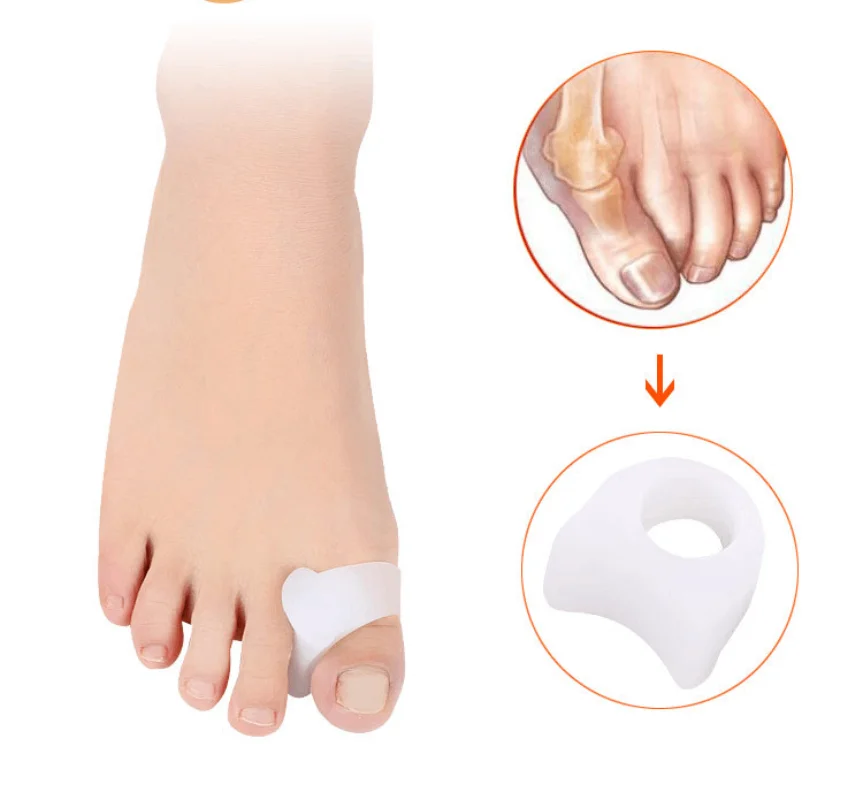 10 أزواج الإبهام فاصل أصابع القدم الورم مصحح جل الوسادة أروح حامي قدم الرعاية العظام فنجر الفواصل لتخفيف الآلام