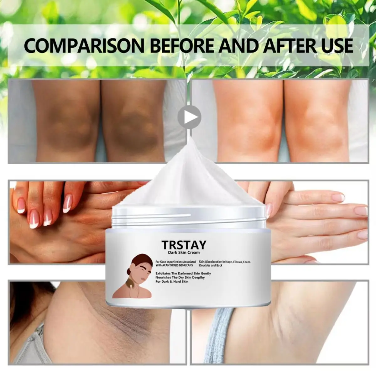TRSTAY Dark Skin Cream Body Nourishing ไวท์เทนนิ่งโลชั่นสําหรับผิวหยาบหมองคล้ําความชุ่มชื้นลึกข้อต่อหลังเหมาะ