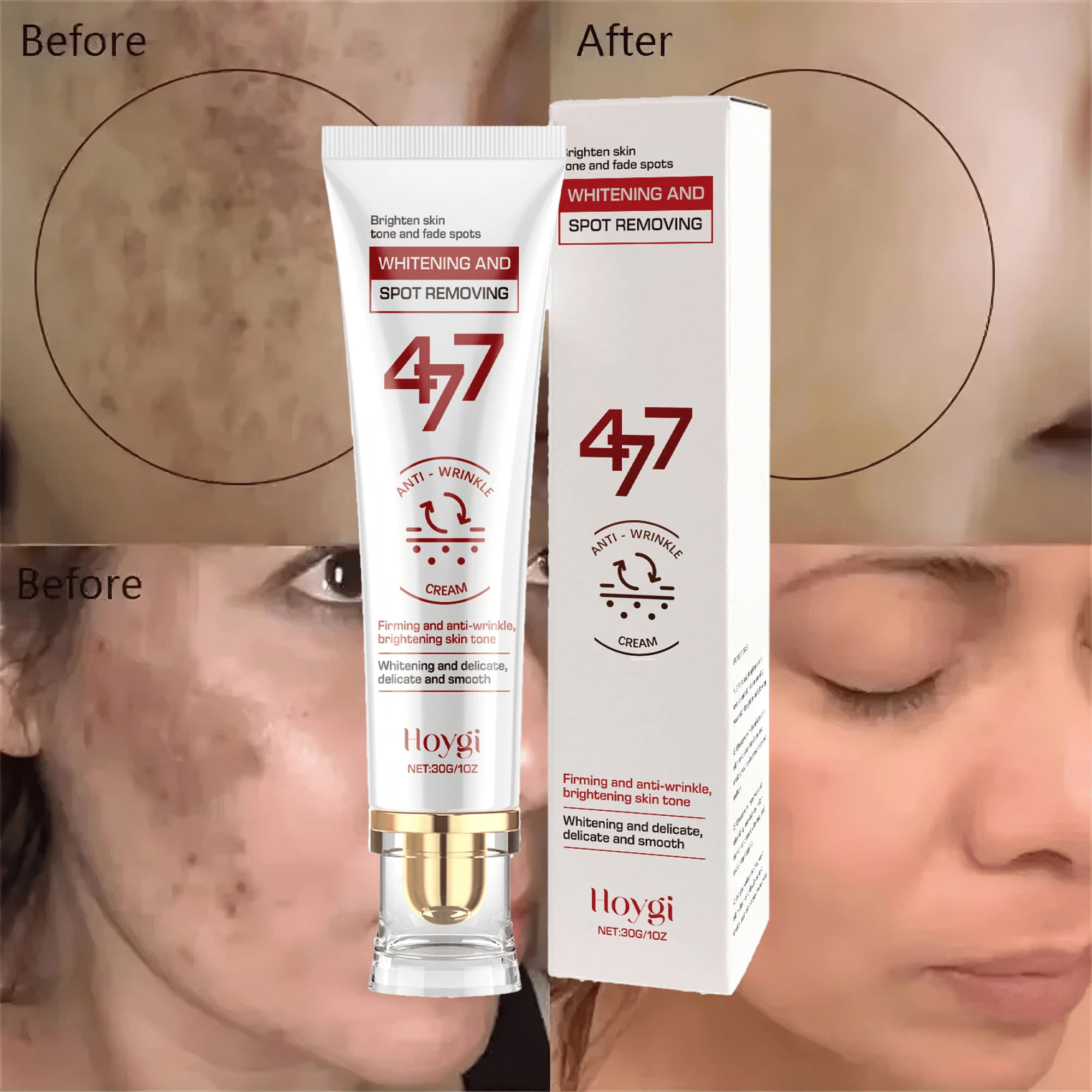 

Powerful Spot-Removing Whiten Cream Brighten Skin Fast Eliminates Melanin Pigmentation Melasma Dark Spots Korean Face Skin Care