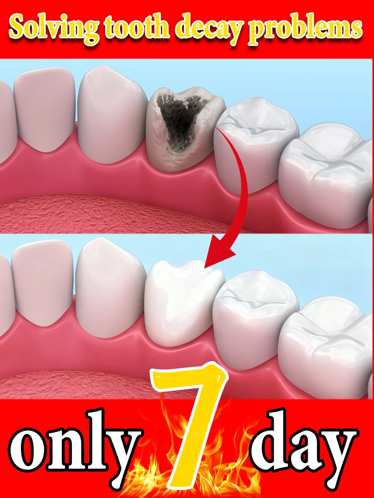 

Hᴇᴀʟs ᴄᴀᴠɪᴛɪᴇs, ᴄʟᴇᴀɴs ᴀᴡᴀʏ ᴘʟᴀᴏ̨ᴜᴇ, ᴡʜɪᴛᴇɴs ʏᴏᴜʀ ᴛᴇᴇᴛʜ