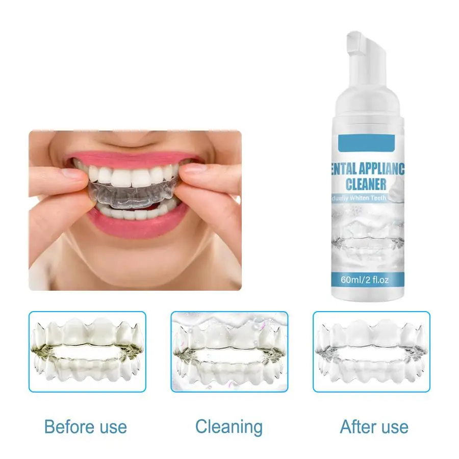 Retainer & Mondbeschermer Schoner Schuim-60Ml: Diep Schoon, Witter, Elimineer Geur & Vergeling Voor Beugels En Aligners