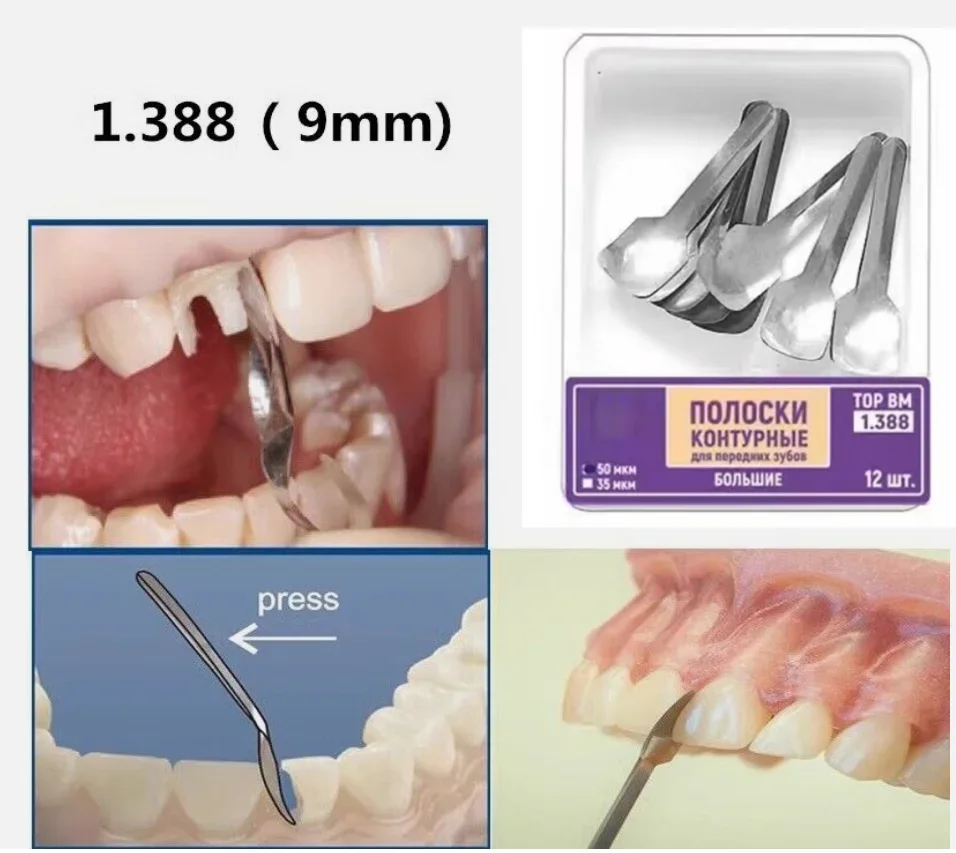 NIGF Tandheelkundige Matrixbanden Grote Kleine Twin Proximale Anterieure Strip Sectionele Voorgevormde Matrices Systemen Tandheelkunde Materialen