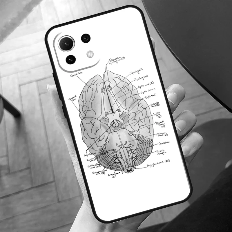 Anatomy Brain Case For POCO X3 X5 X6 F6 Pro M6 M5s F3 F5 Xiaomi 13T Pro 11T 12T 12 Lite 13 14 Ultra Cover