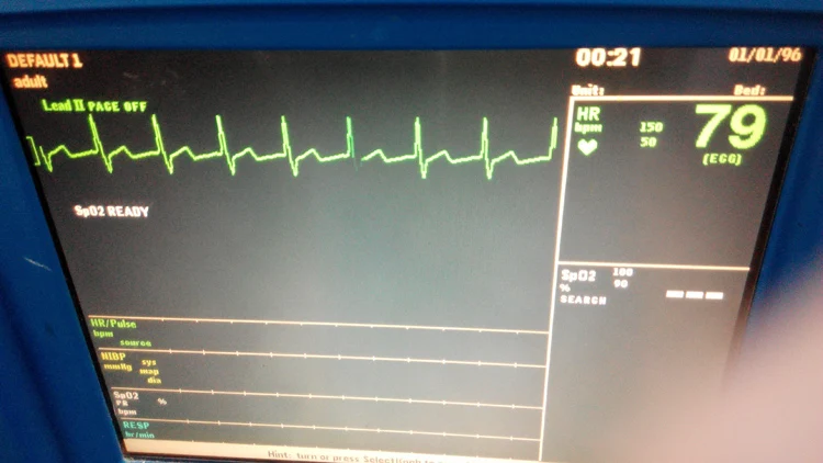 Imagem -02 - Gerador de Simulação de Sinal de Pulso Dg1000 Gerador de Sinal Ecg Gerador de Sinal