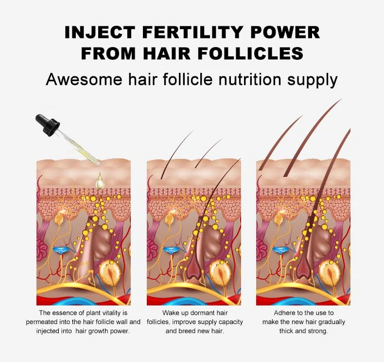 Hair Growth Oil Ginger Biotin Serum Natural Hair Loss Treatment for Men Women Thicker Hair Repair Scalp Care Essential Oil Set - view 5