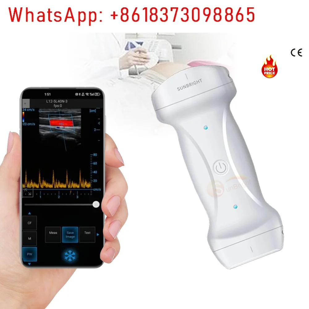 1pcsSUN-D7 can use WIFI and USB wireless dual-head veterinary ultrasound probe mini wireless ultrasound machine at the same time