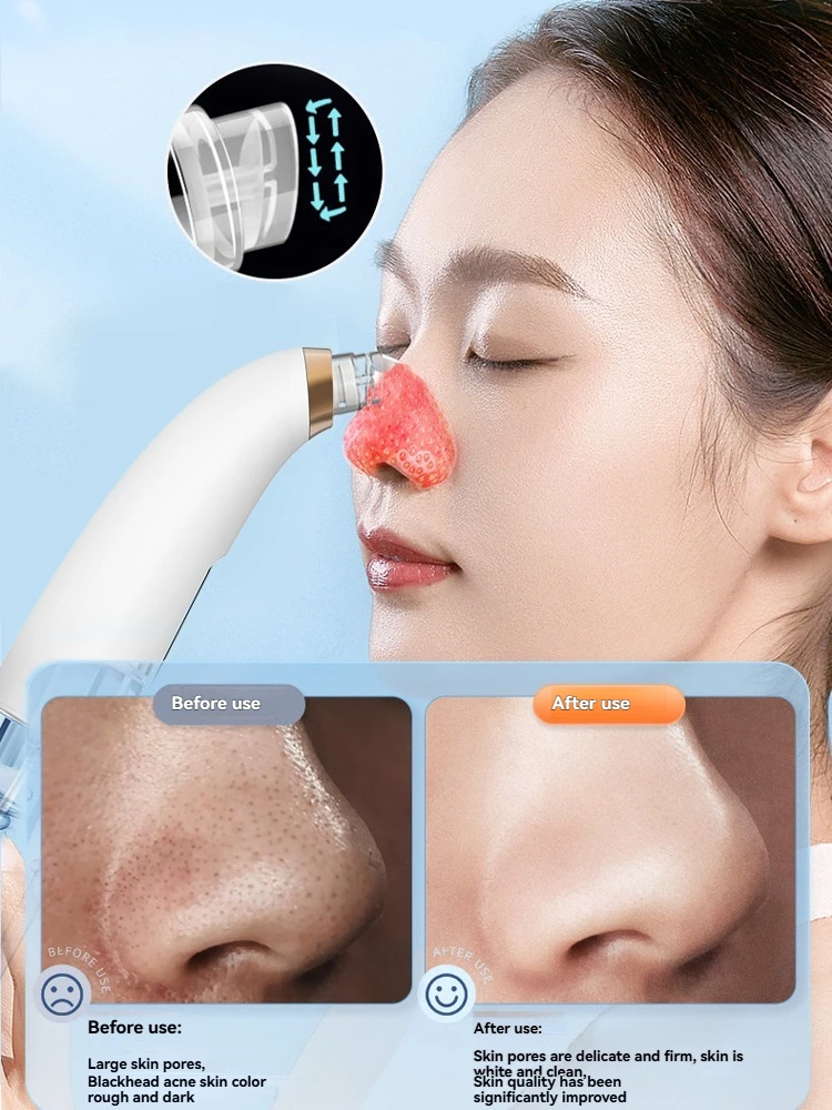 Micro-Bubble Blackhead Extractor Vacuum Cleansing Device Deep Cleansing for Blackhead Removal Oxygen Infusion & Hydration Facial
