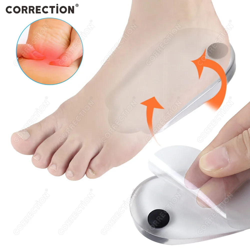 2/4 PCS Orthopedic Insoles for Feet O/X Leg Type Valgus Correction Men Women Silicone Gel Shoes Insole Magnet Massage Shoe Pads