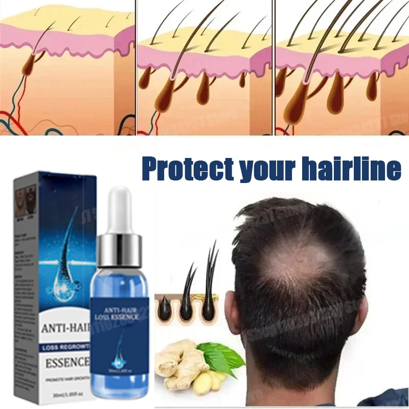 Hair Care for Men Women Hair Oil Anti Hair Loss prevention Scalp nourishment Serum