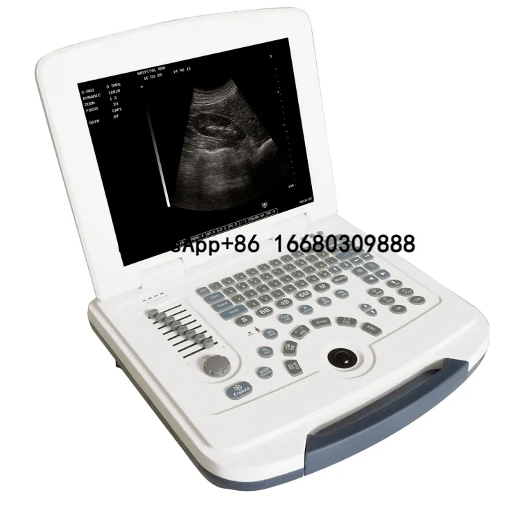 

Stock !!!china Portable dawei Laptop ultrasound machine for MSLPU09 with multiply language