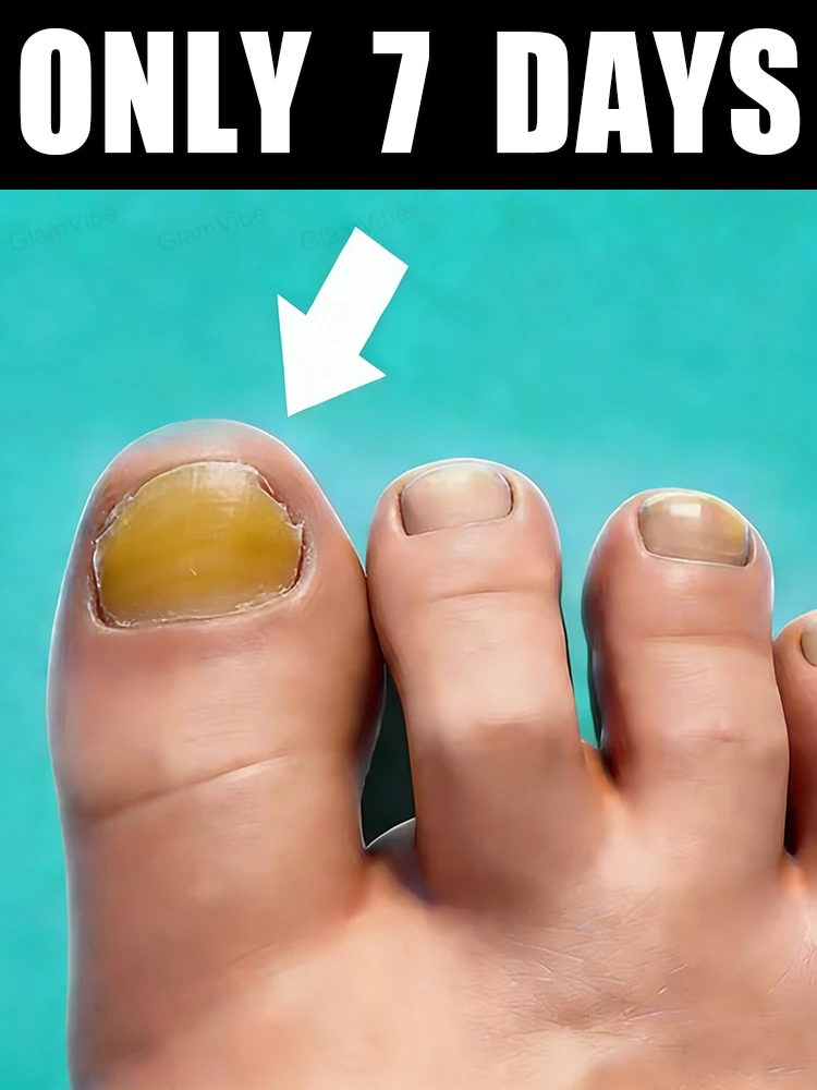 

Скажи прощай, чтобы несетмя и желтыми ногтями, создают аккуратные и хрустальные ногти!