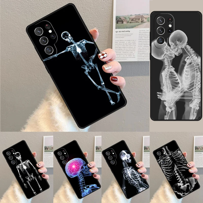 Röntgen-Anatomie-Motiv Weiche TPU-Handyhülle für Samsung Galaxy Note 10 Pro S26 S25 S24 S23 S22 Ultra Plus S21 FE S20 Cover