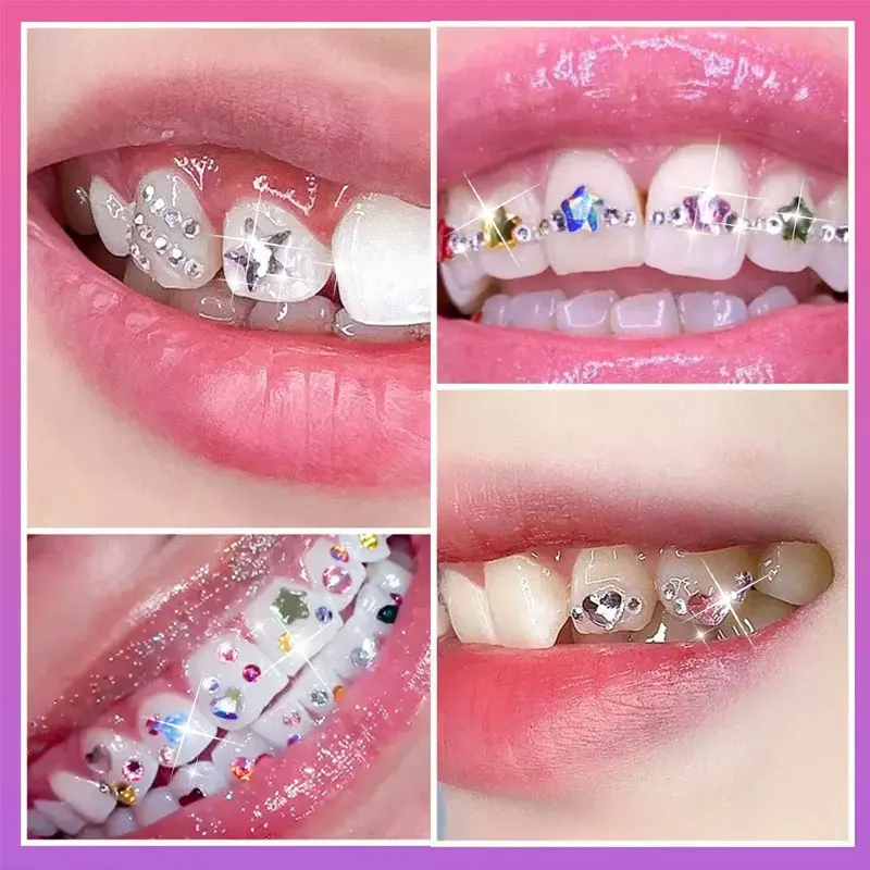 Multi‑Shape Tooth Gem Kit Colorful Crystal Teeth Gems DIY Set with Resin 37% Acid Etchant LED Curing Light Teeth Ornament Kit