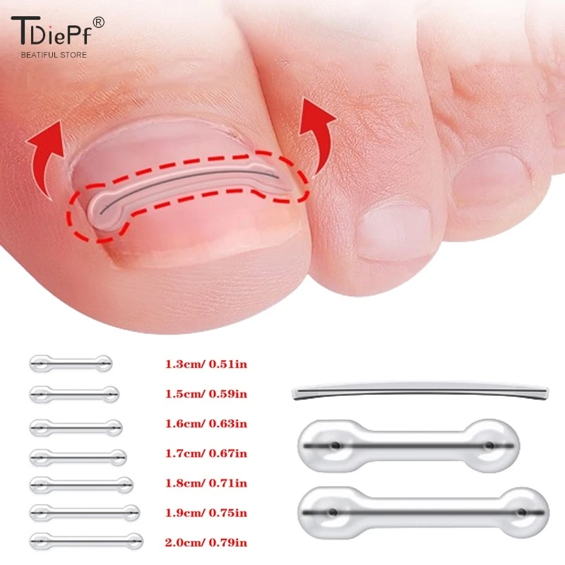 1Pc Foot Ingrown Toenail Correction Tool Ingrown Toe Nail Treatment Elastic Patch Sticker Straightening Clip Brace Pedicure Tool