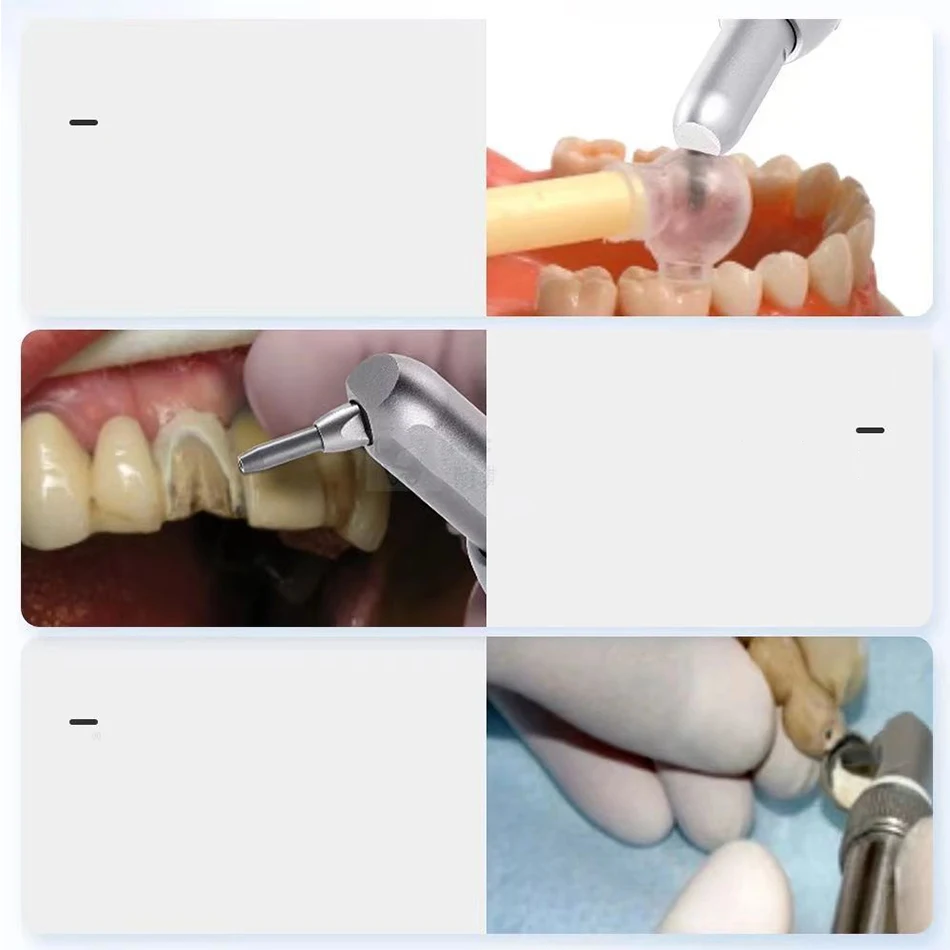 Pistola Dental de óxido de aluminio, herramienta de odontología, microblaster, interfaz, chorro de arena, pulidora de abrasión de aire