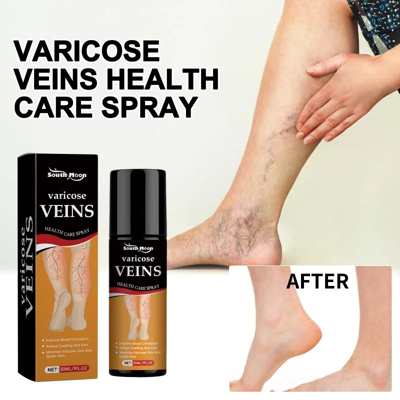 

Vein Health Care Spray Soothes Leg Fatigue Reduces Soreness Convenient Application