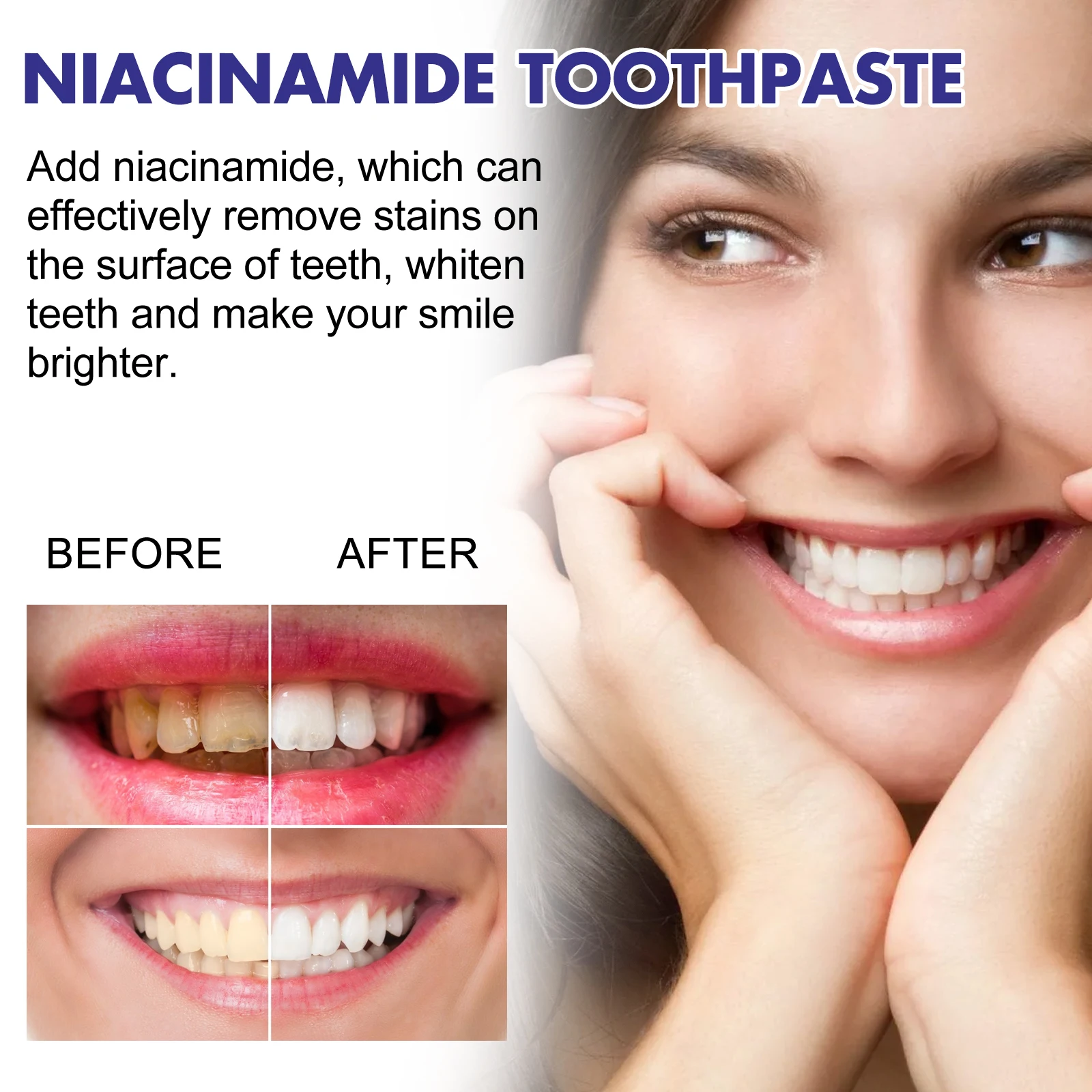 Teeth Cleaning And Whitening Toothpaste Removes Stains, Whitens Teeth,Supports Cavity Treatment And Improves Tooth Bleeding