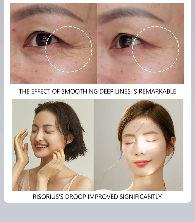 جهاز التجميل للمكتبة الذكية متعدد الوظائف لشد الشد ومضاد للتجاعيد وتبريد الوجه ومضاد للشيخوخة #6