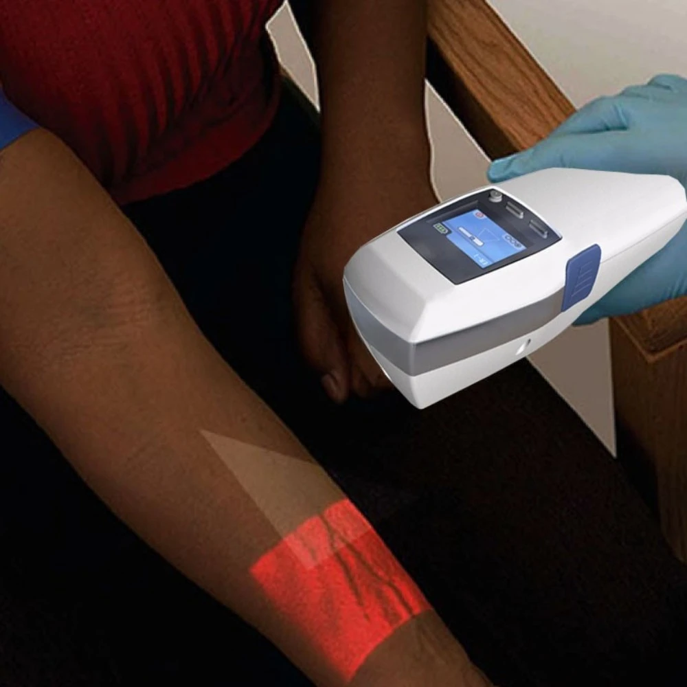 Vascular Imager Vein Vascular Finder Charging Handheld Projection