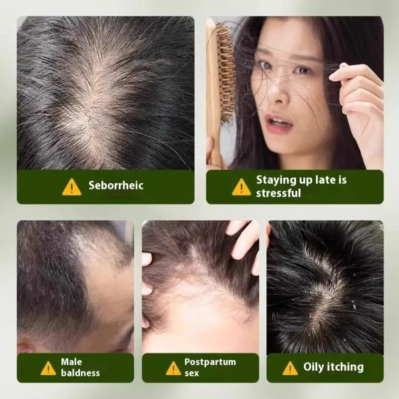 New 120g Usman Grass Handmade Soap Effectively Cleansing Scalp Strengthening Hair Roots Reducing Hair Loss Plant Soap