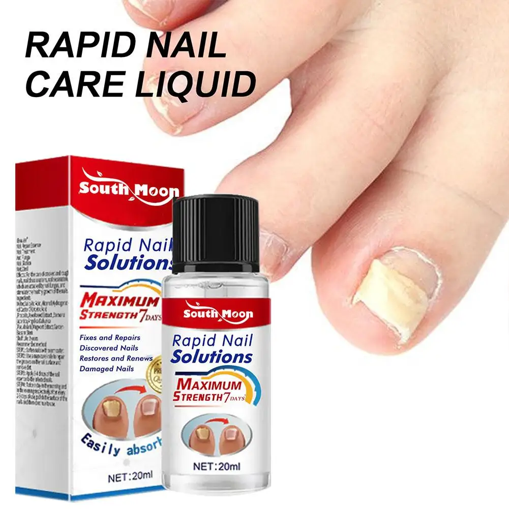 Nail Fungal Treatment Serum Anti Infection Onychomycosis Paronychia Removal Rapid Fungal Care Fast Gel Foot Hand Repair Toe C6H4