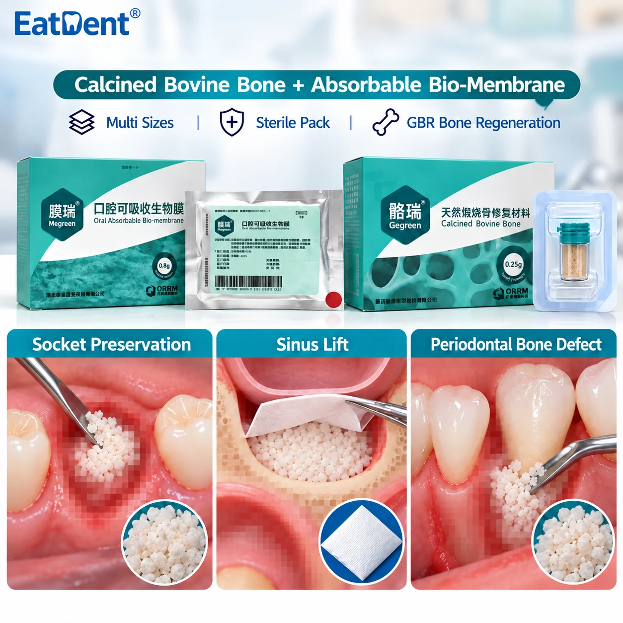 Dental Biofilm Bone Meal Membrane Absorbable Biofilm Material Oral Cavity Calcified Bone Granular Type Bone Repair Material Tool