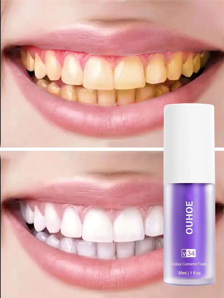 

Teeth whitening effective toothpastes products