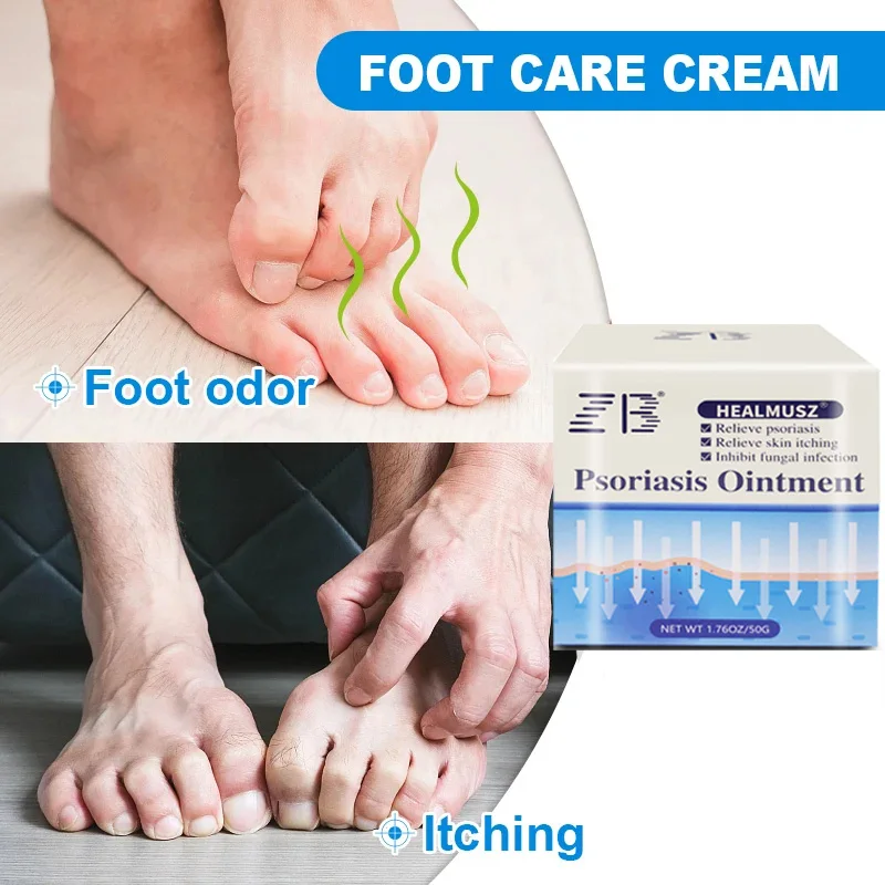 50g Chinese Beriberi Ointment Inhibit Fungi Remove Odor Repair Foot Skin Athlete\'s Foot Treatment Cream Tinea Pedis Cream