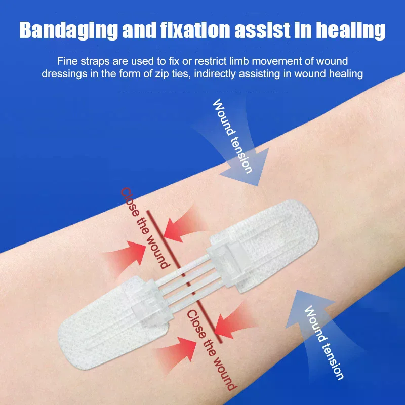 /Kuz/Zipper Band-aid Painless Wound Closure Device Suture-free Wound Dressing Patches Zip Suture Reducer Band Aid