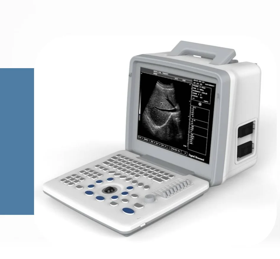 Portable black and white ultra s300 with abdominal convex array probe