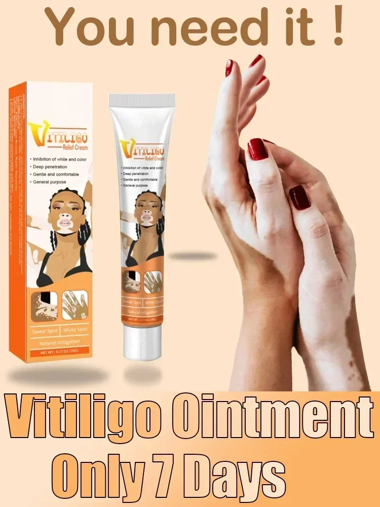 Pomada de Vitiligo para el cuidado de la piel corporal, elimina eficazmente el Vitiligo, manchas blancas, sf77