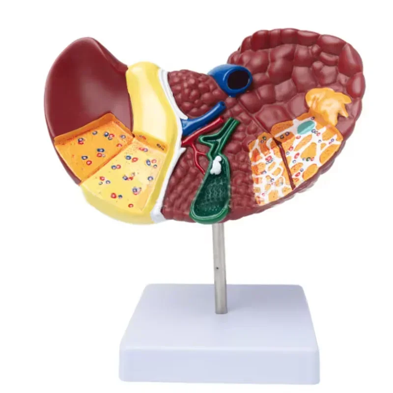 Patologiczny model anatomiczny wątroby 1:1 Model wątroby ludzkiej Wyświetlacz anatomiczny do nauki i badań szkół medycznych