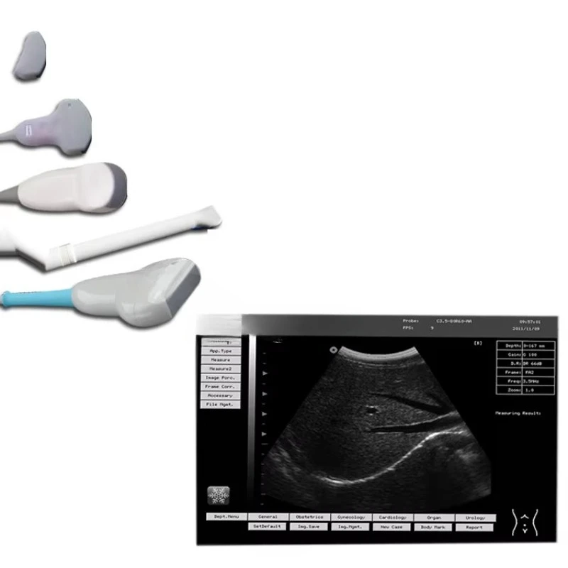 

Portable Ultrasound Portable Ultrasound Diagnostic Doppler Ultrasound Equipment