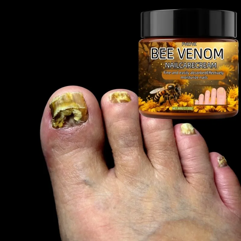 ครีมทาเล็บอันทรงพลัง เหมาะสำหรับการดูแลเล็บที่แห้ง หยาบกร้าน เปราะบาง ช่วยให้เล็บแข็งแรง ลดการเหลือง ซึมซาบเร็ว บำรุงให้ความชุ่มชื้น และเรียบเนียน