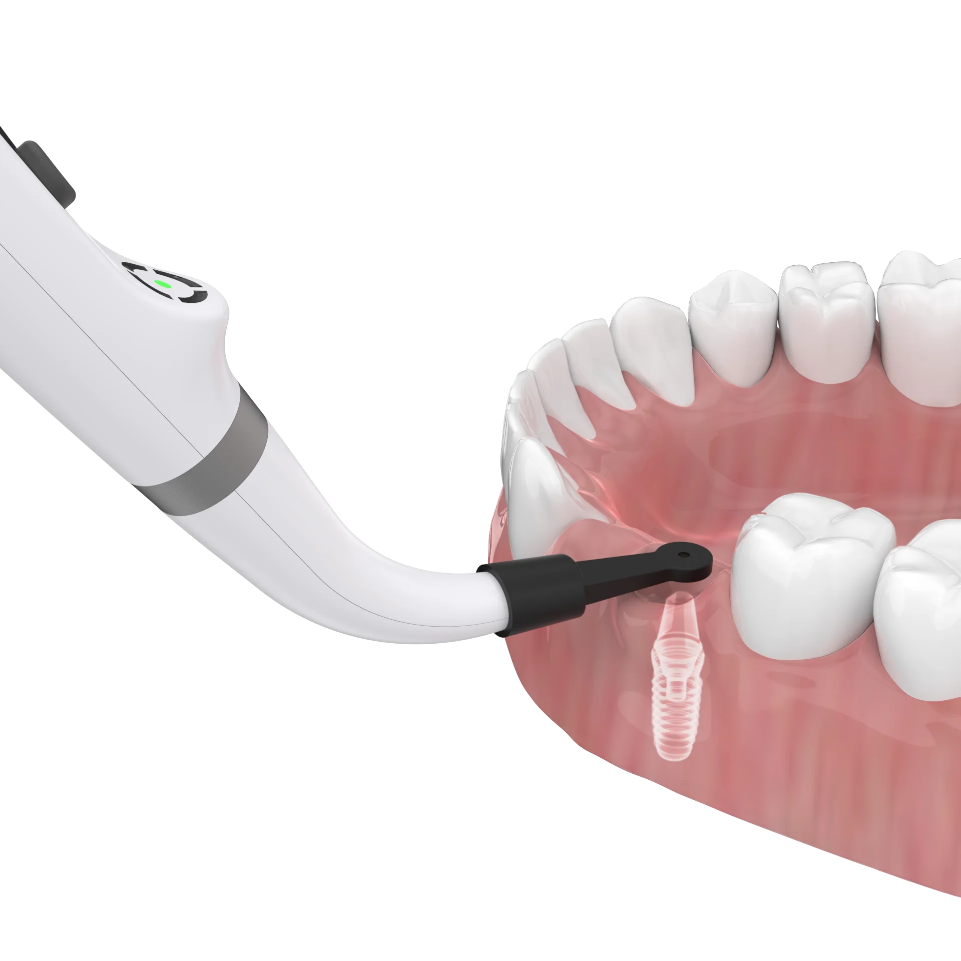 VVDental Dental Implant Locator 360 Rotatable Cross Scanning Sensor Precision Implant Localization Detector